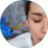 PRP Facial